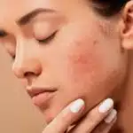 Common Skincare Mistakes